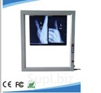 X-ray film Viewer Trible